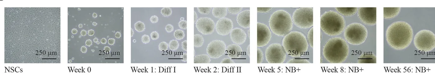 Forebrain organoids at successive stages of differentiation and maturation