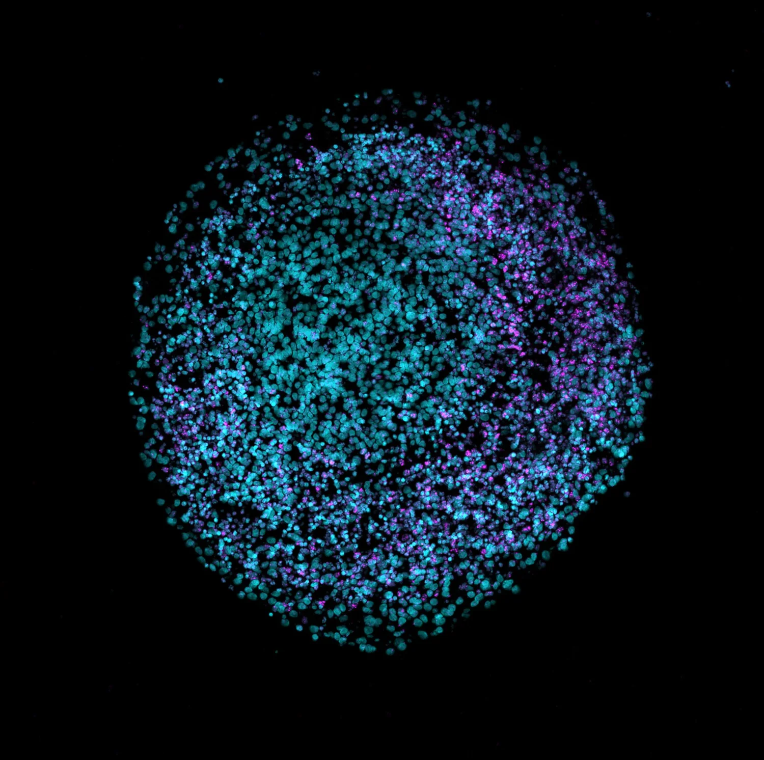 Fluorescence micrograph of a human brain organoid
