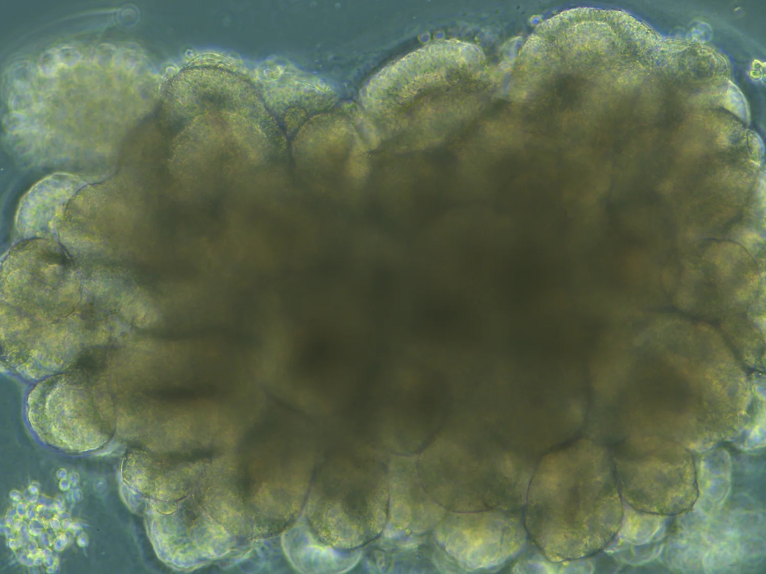 Brightfield micrograph of a developing human cerebral organoid